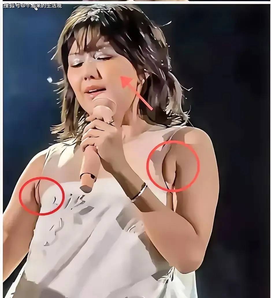 jinnianhui金年会官网孙燕姿演唱会被吐槽衣品差膀子太大发福成大妈脸上皮肤(图1)